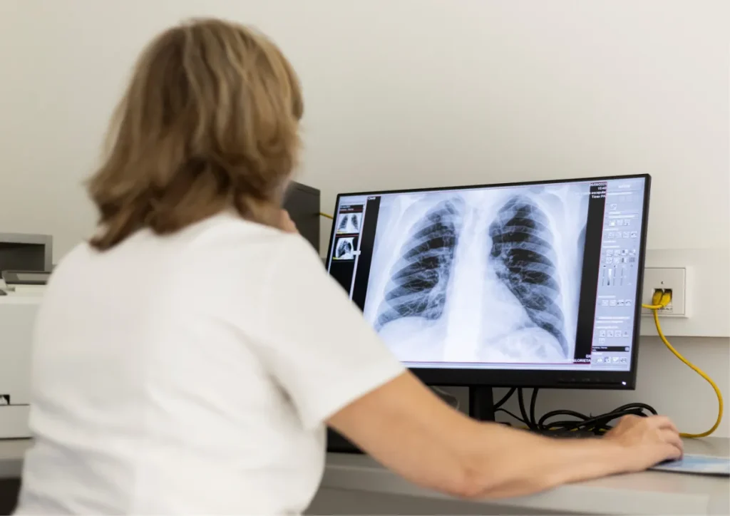 Lectura de una radiografía de tórax en la sala de radiología de Policlínica Glorieta, Dénia