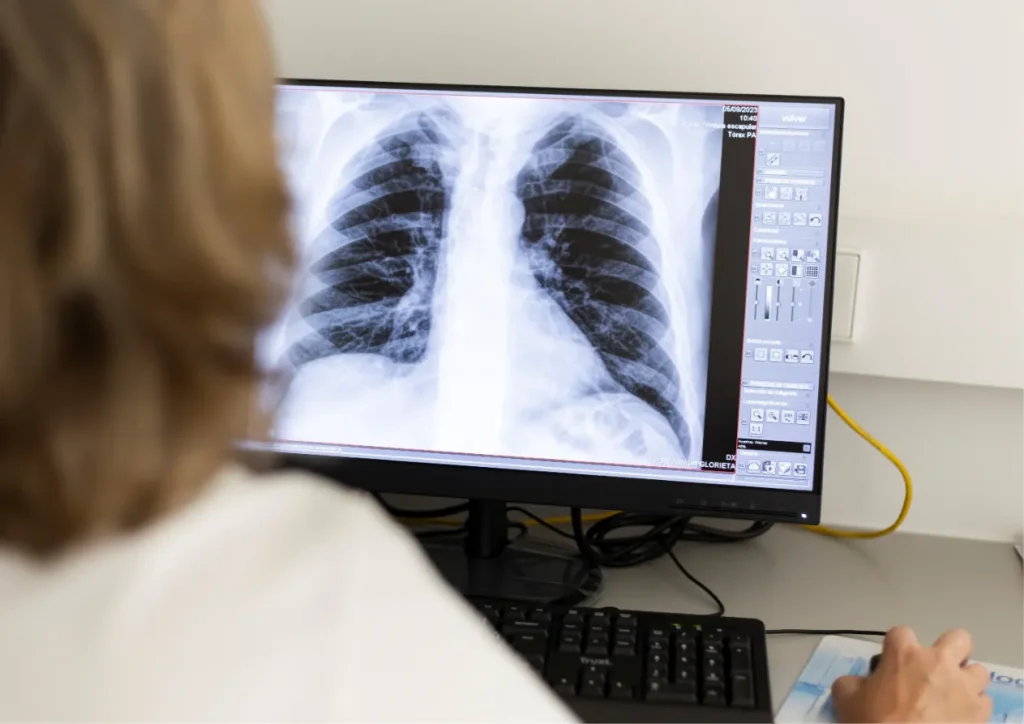 Revisión de una radiografía de tórax en el servicio de radiología de Policlínica Glorieta, Dénia